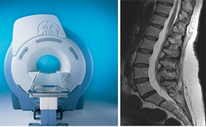 This is a picture of the MRI Machine and a MRI Imagine